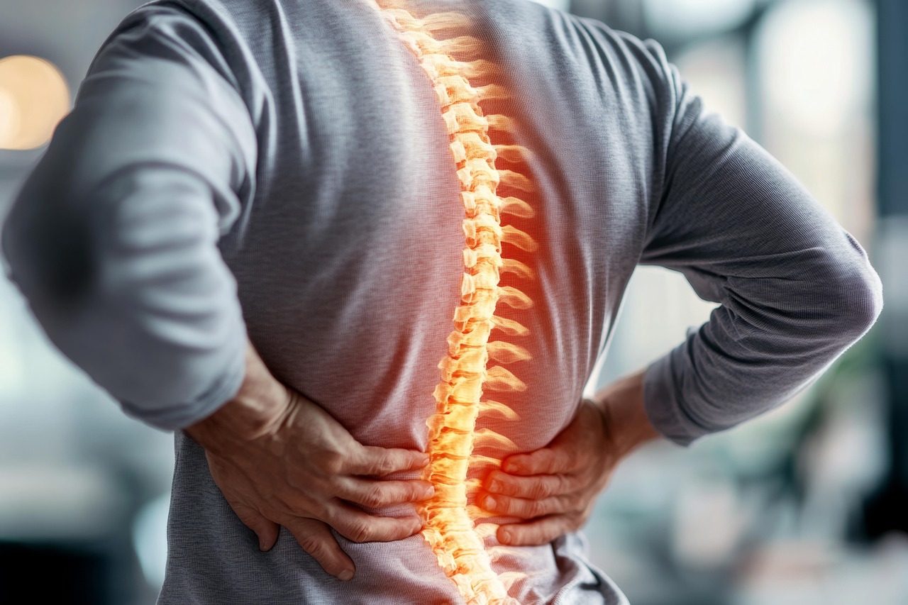 herniated-disc-sccplano-8941861_1280