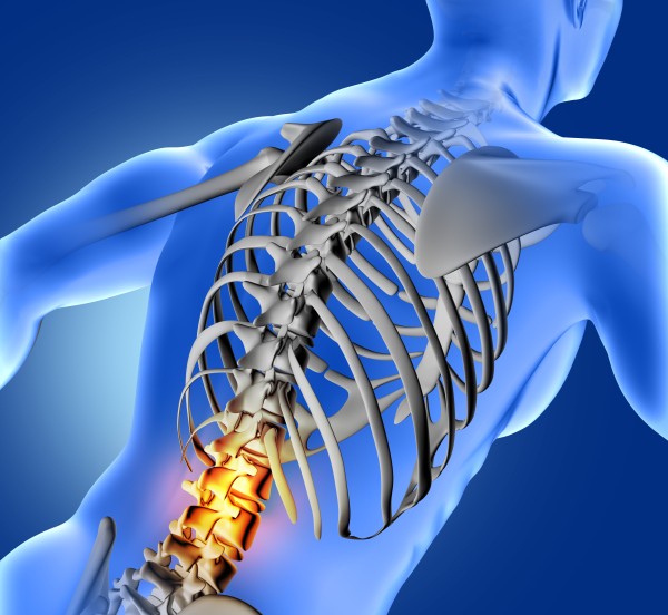 Spinal Fracture