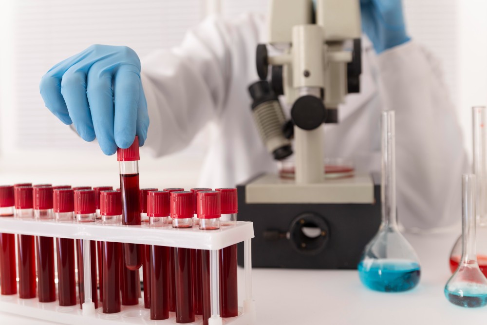 PCP Blood Tests