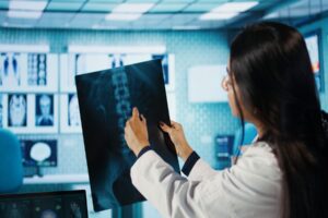 Signs of Spinal Fracture